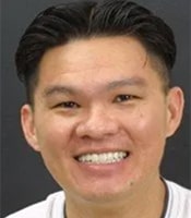 Shaw After Treatment