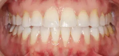 From Chronic Pain to Life-Changing Relief