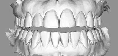 From Chronic Pain to Life-Changing Relief