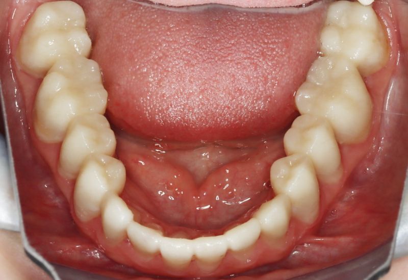 Tatum’s Journey to a Pain-Free Life and Restful Sleep