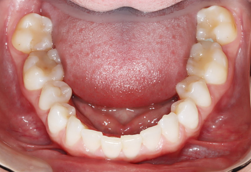 Tatum’s Journey to a Pain-Free Life and Restful Sleep