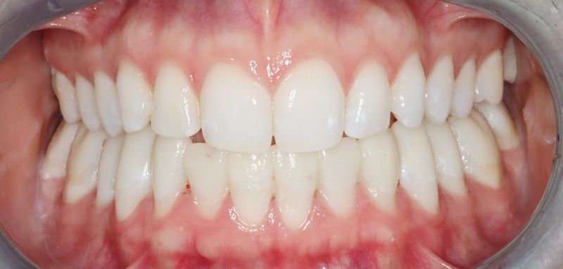 Tatum’s Journey to a Pain-Free Life and Restful Sleep